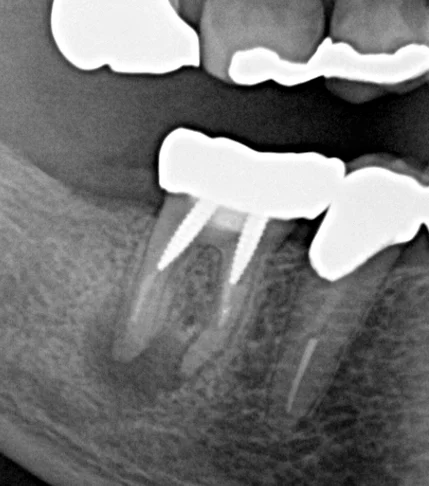 ブログ・お役立ち情報｜坂寄歯科医院（取手市藤代）