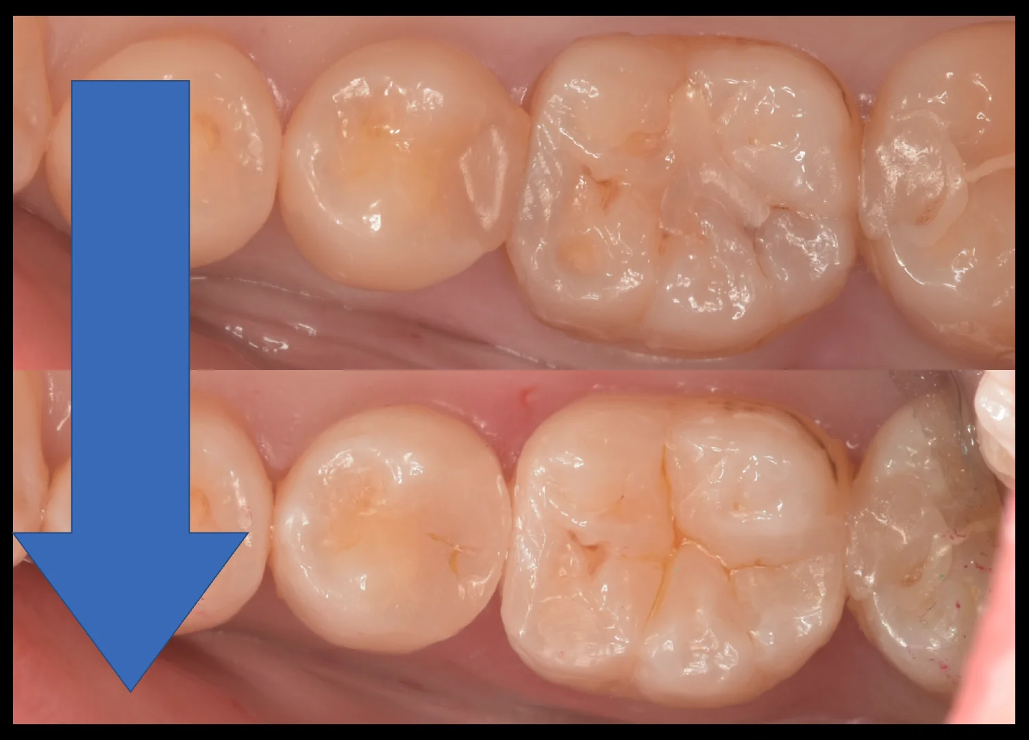 三鷹より来院された方｜坂寄歯科医院（取手市藤代） - 画像9