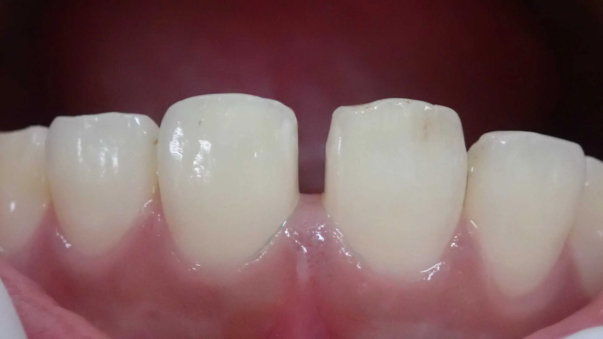 ブログ・お役立ち情報｜坂寄歯科医院（取手市藤代）