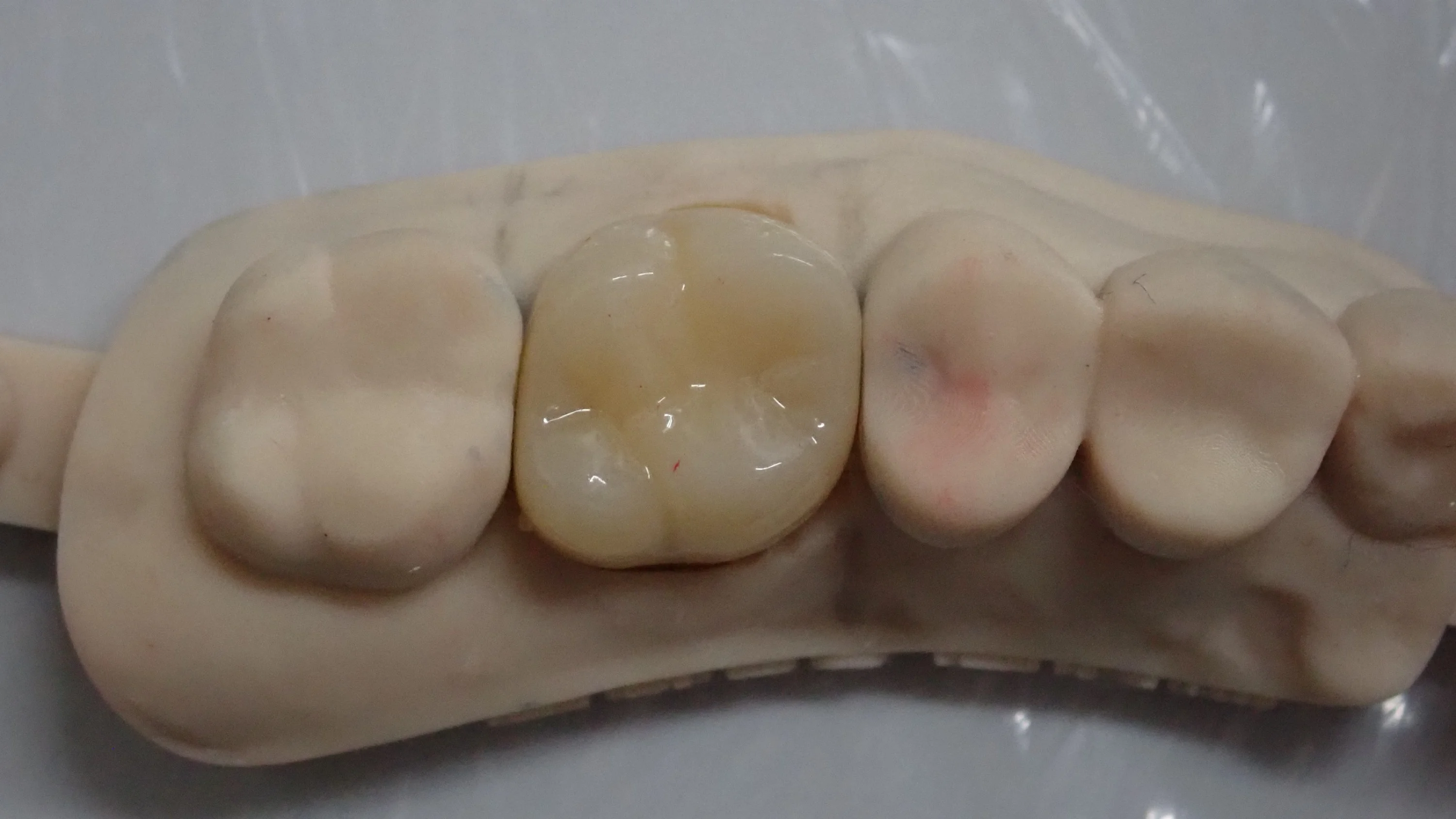 ブログ・お役立ち情報｜坂寄歯科医院（取手市藤代）