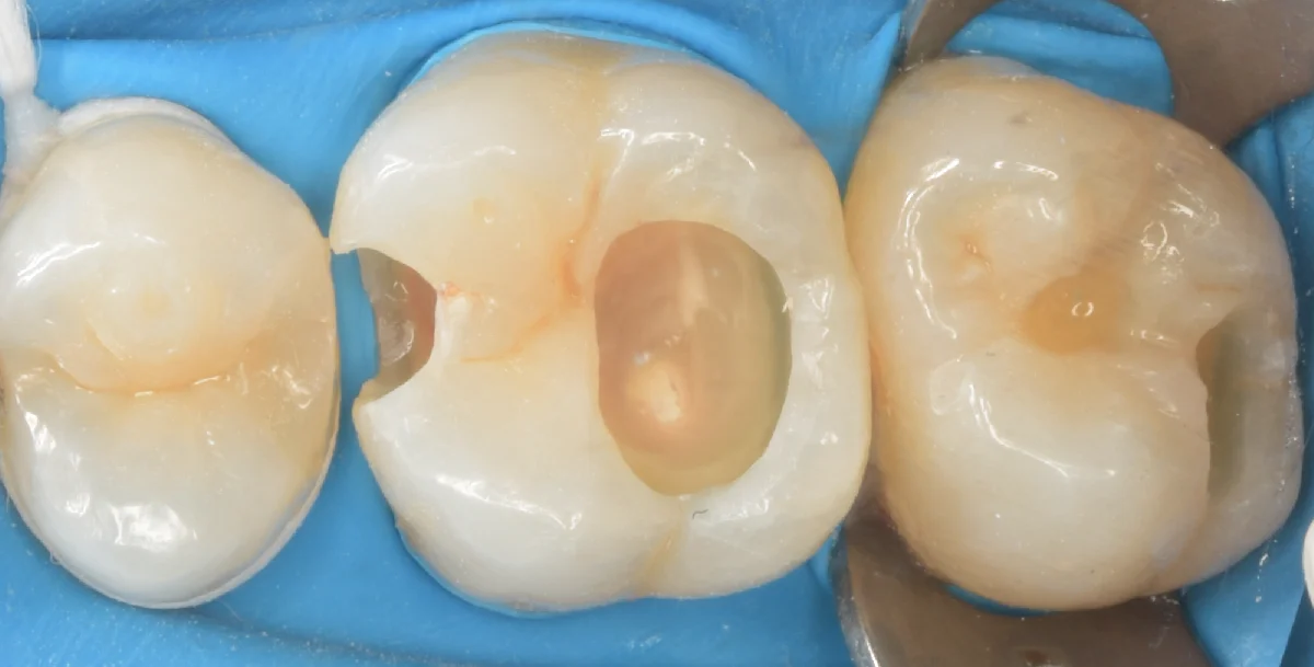 印西市からお越しの方。｜坂寄歯科医院（取手市藤代） - 画像2