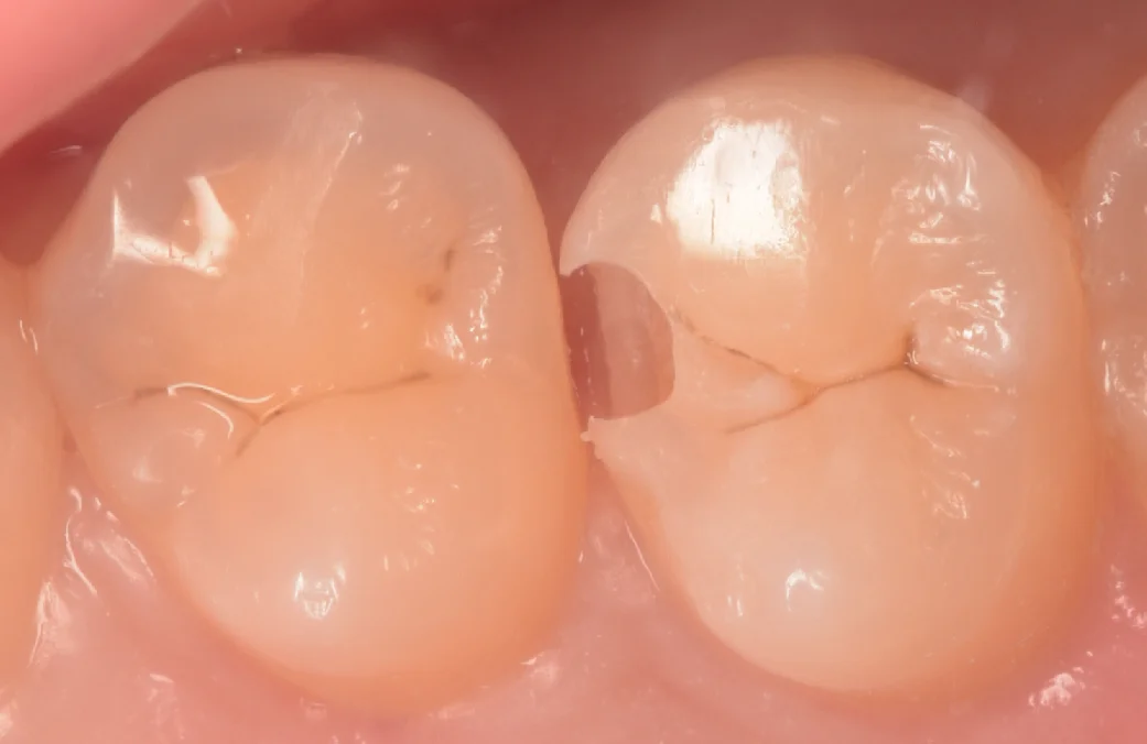 神奈川からお越しの歯科医師の方｜坂寄歯科医院（取手市藤代） - 画像2