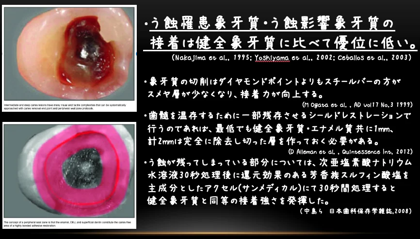 歯学部生をダイレクトで。｜坂寄歯科医院（取手市藤代） - 画像4