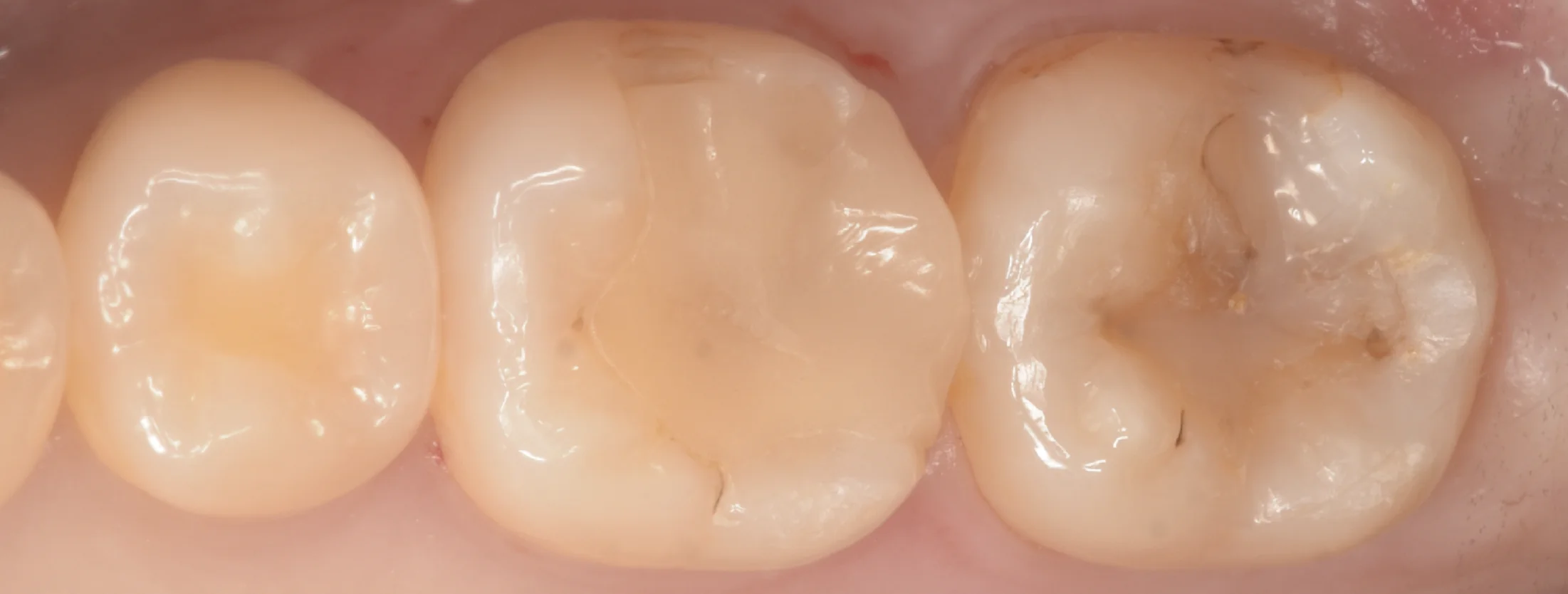 ブログ・お役立ち情報｜坂寄歯科医院（取手市藤代）
