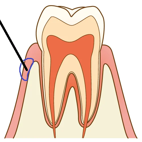 ブログ・お役立ち情報｜坂寄歯科医院（取手市藤代）