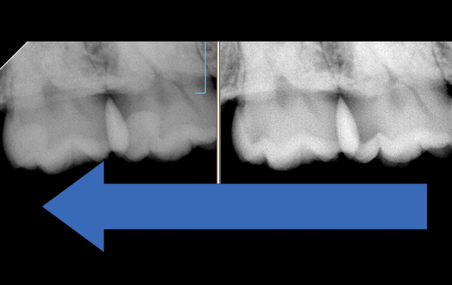群馬からお越しの歯科医師の方。|坂寄歯科医院(取手市藤代) - 画像6