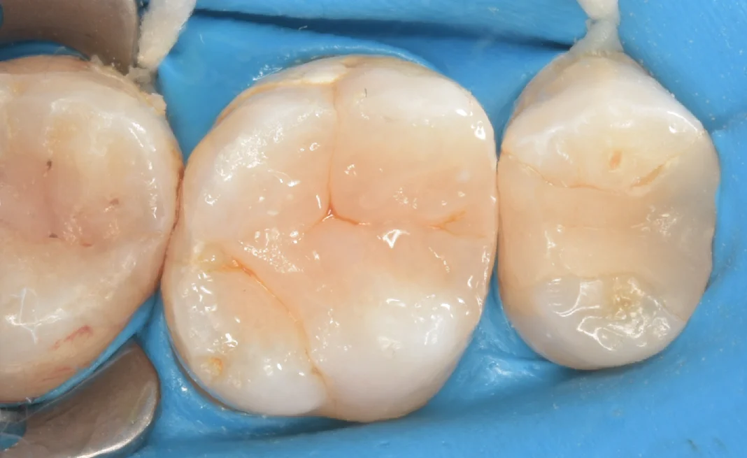 新宿からお越しの方｜坂寄歯科医院（取手市藤代） - 画像4