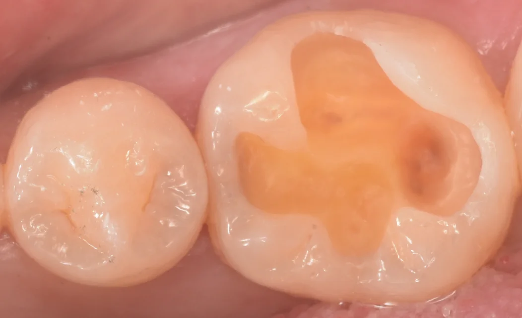 印西からお越しの方｜坂寄歯科医院（取手市藤代） - 画像4