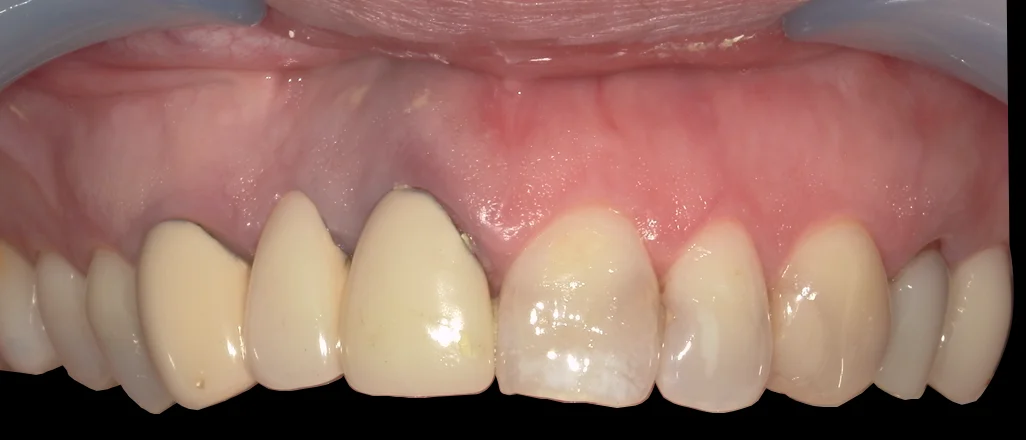 ブログ・お役立ち情報｜坂寄歯科医院（取手市藤代）