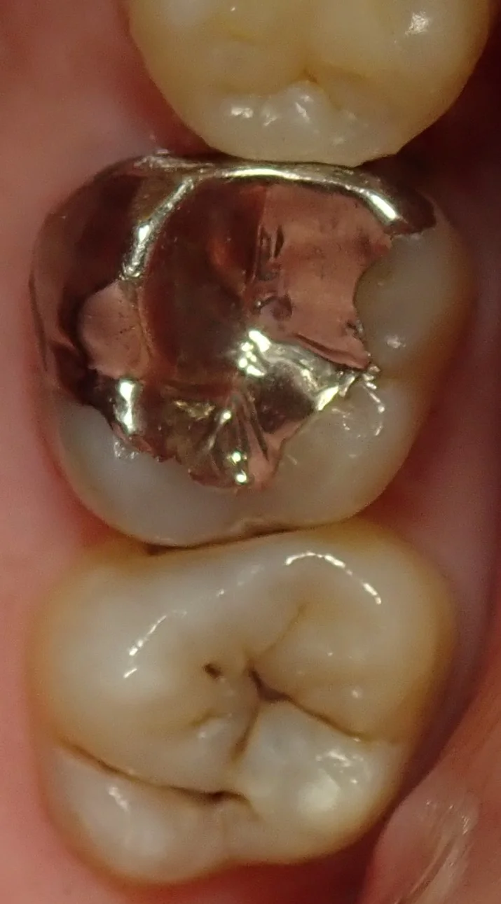 ブログ・お役立ち情報｜坂寄歯科医院（取手市藤代）