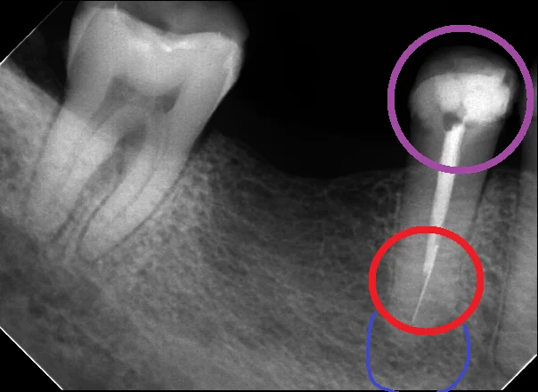 ブログ・お役立ち情報｜坂寄歯科医院（取手市藤代）