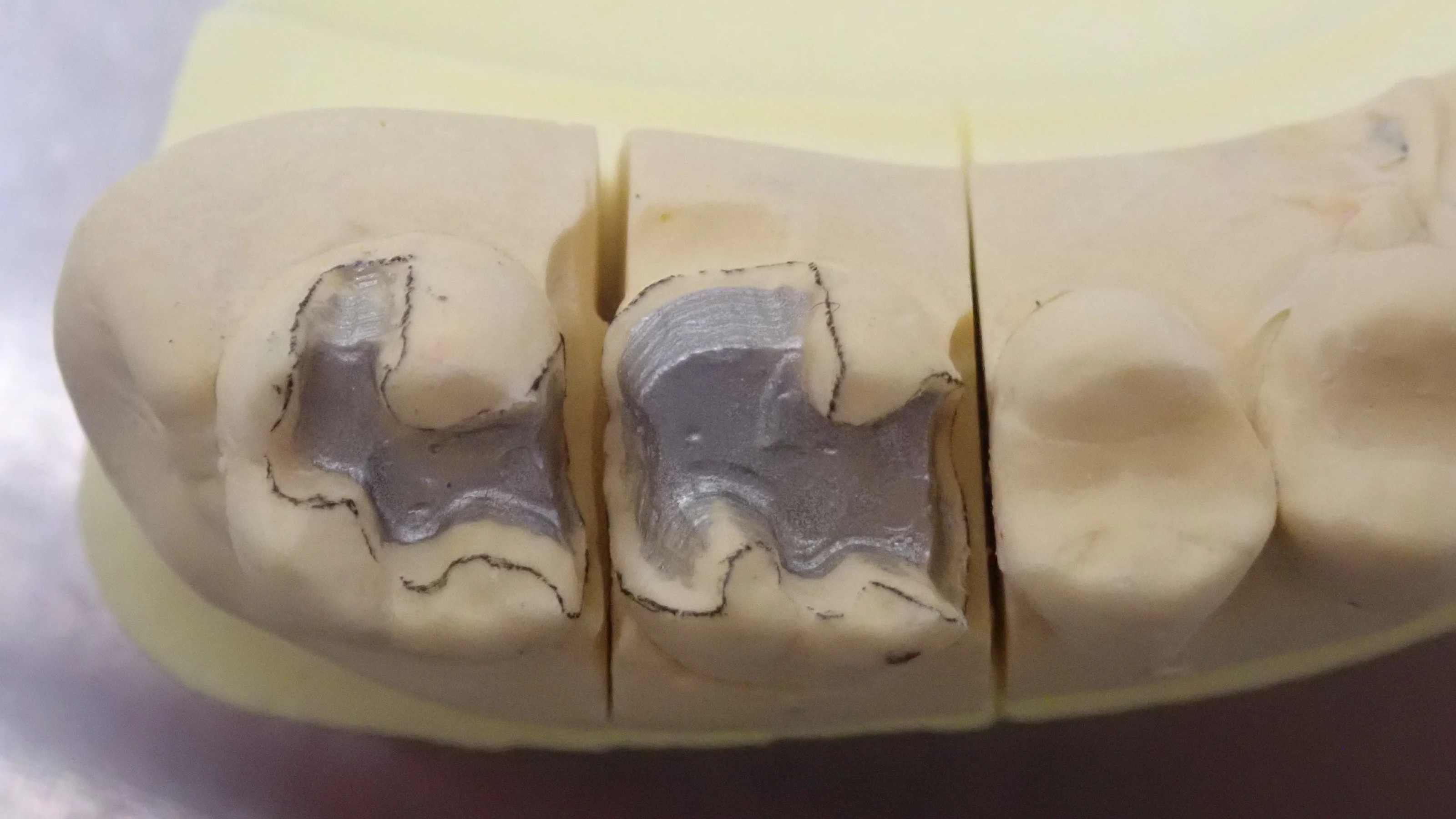 ブログ・お役立ち情報｜坂寄歯科医院（取手市藤代）