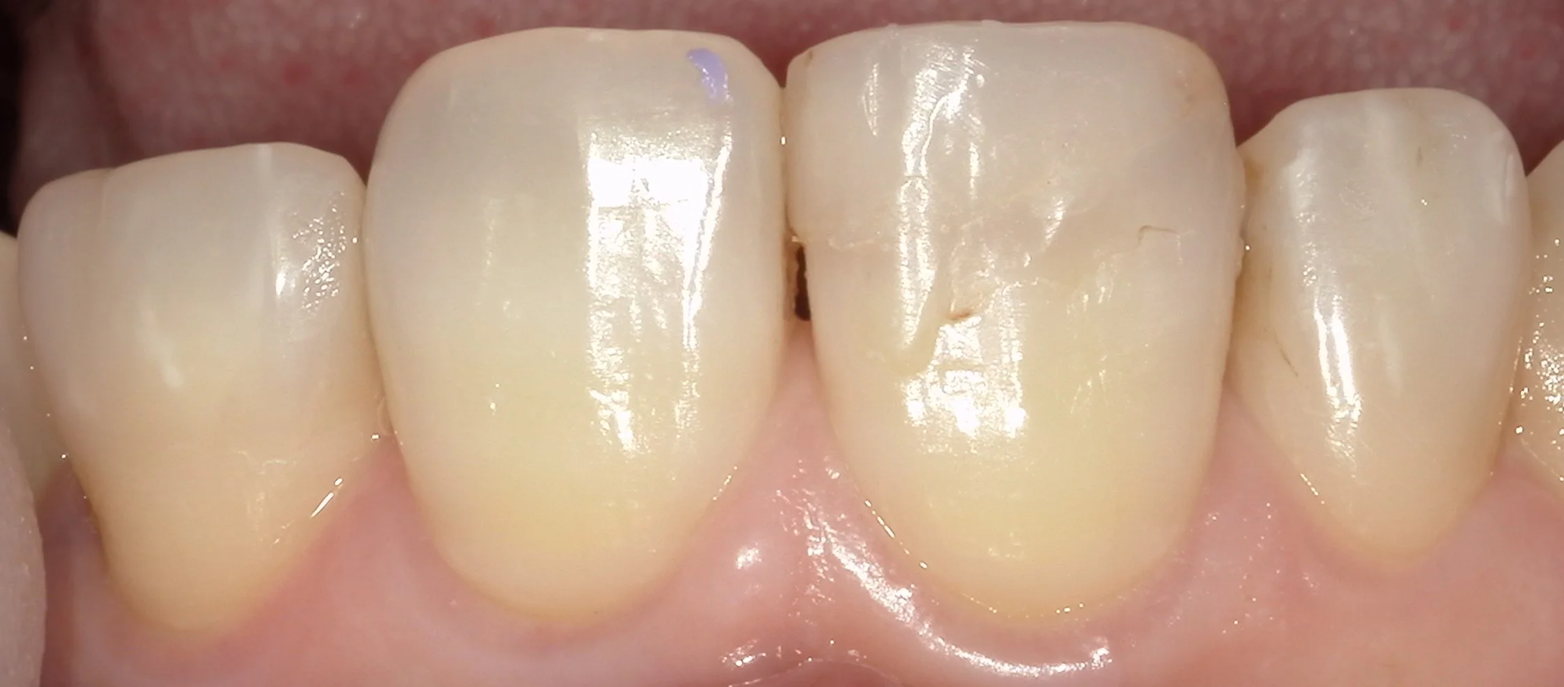 ブログ・お役立ち情報｜坂寄歯科医院（取手市藤代）