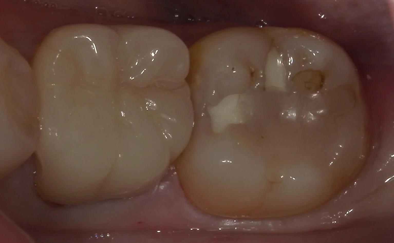 ブログ・お役立ち情報｜坂寄歯科医院（取手市藤代）