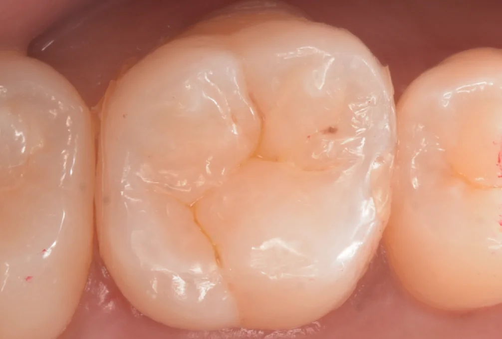 印西からお越しの方。｜坂寄歯科医院（取手市藤代） - 画像5