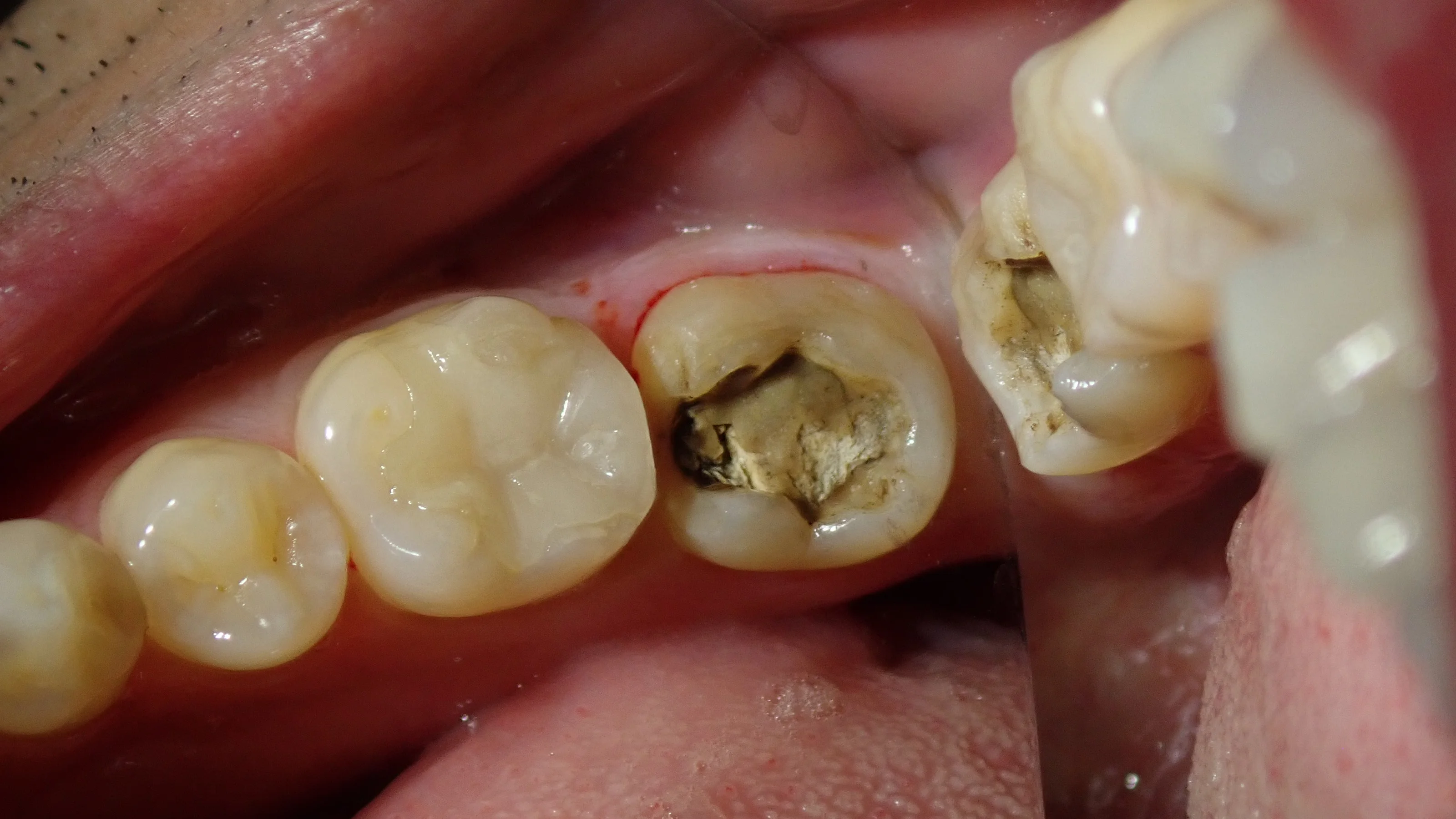 ブログ・お役立ち情報｜坂寄歯科医院（取手市藤代）