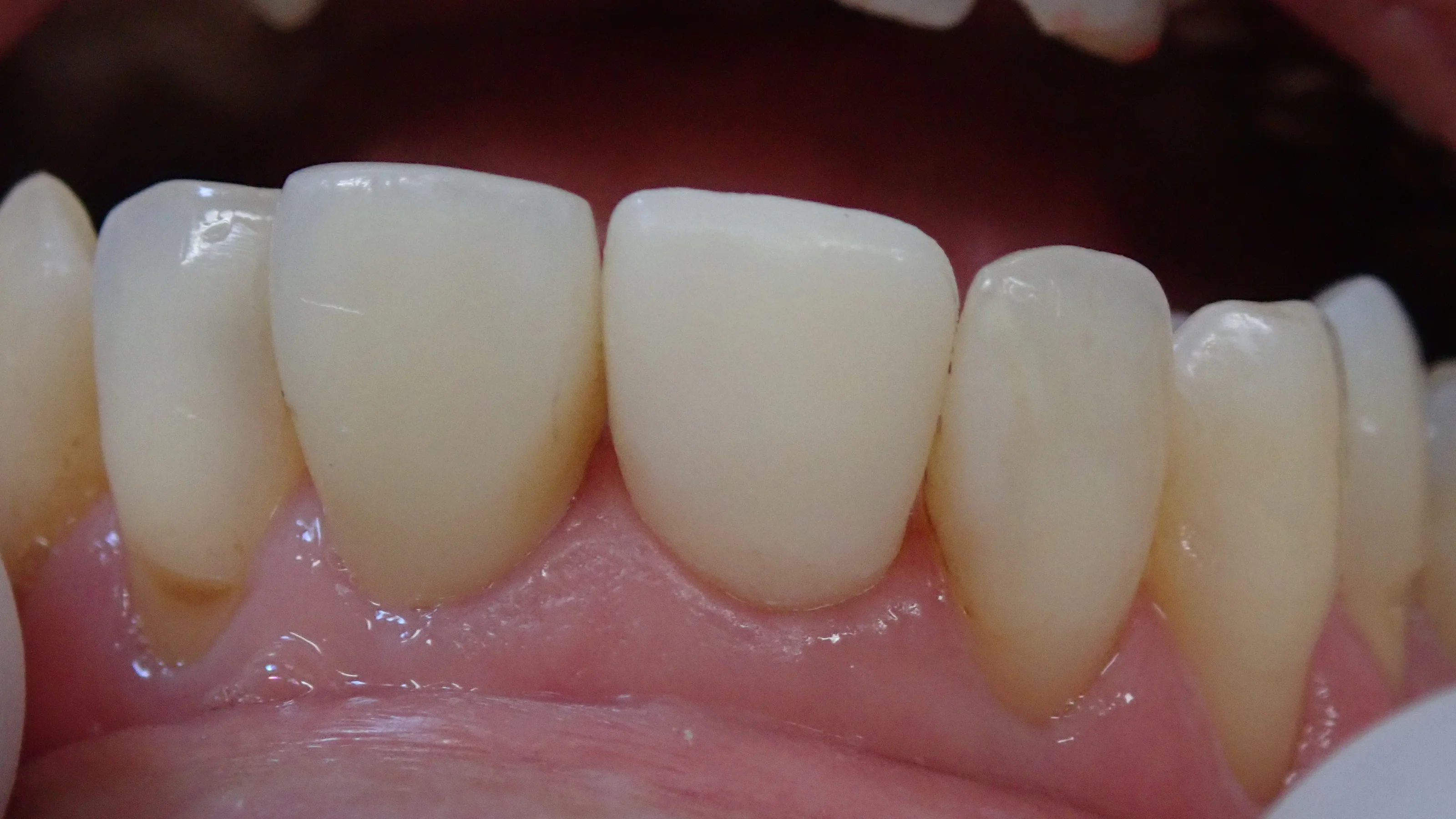 ブログ・お役立ち情報｜坂寄歯科医院（取手市藤代）