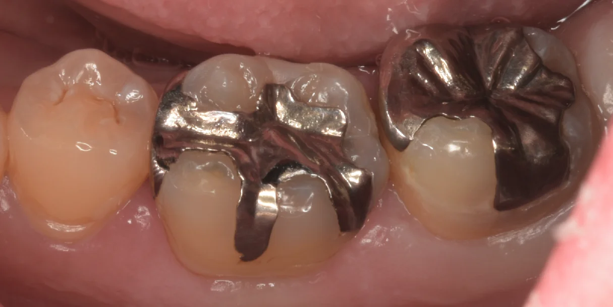 ブログ・お役立ち情報｜坂寄歯科医院（取手市藤代）