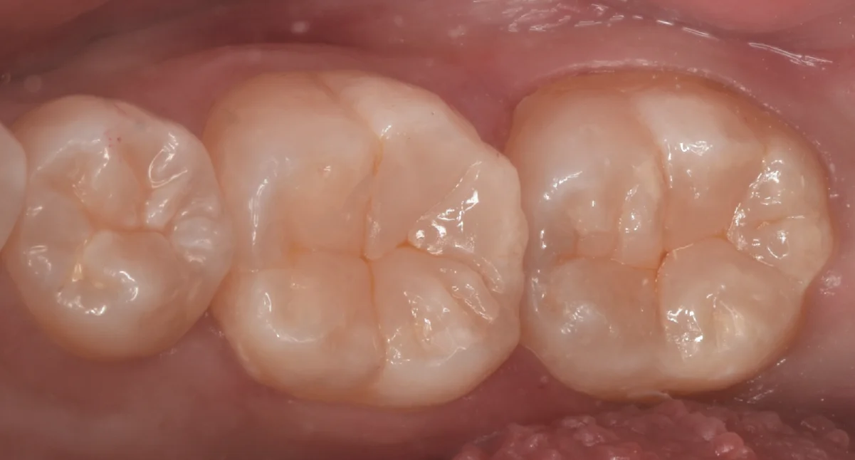 竜ヶ崎市からお越しの方。|坂寄歯科医院(取手市藤代) - 画像4