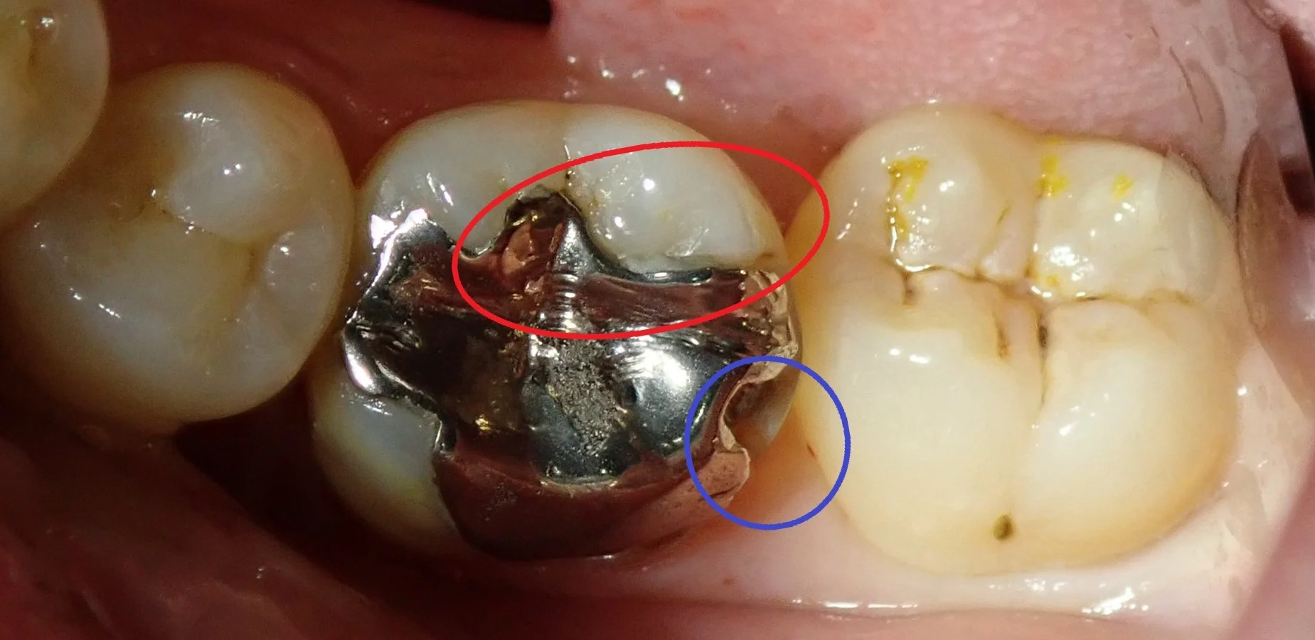 ブログ・お役立ち情報｜坂寄歯科医院（取手市藤代）