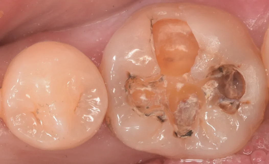 印西からお越しの方｜坂寄歯科医院（取手市藤代） - 画像3