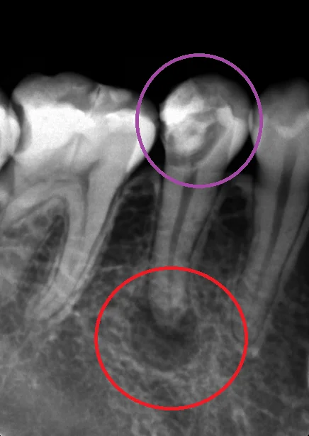 ブログ・お役立ち情報｜坂寄歯科医院（取手市藤代）
