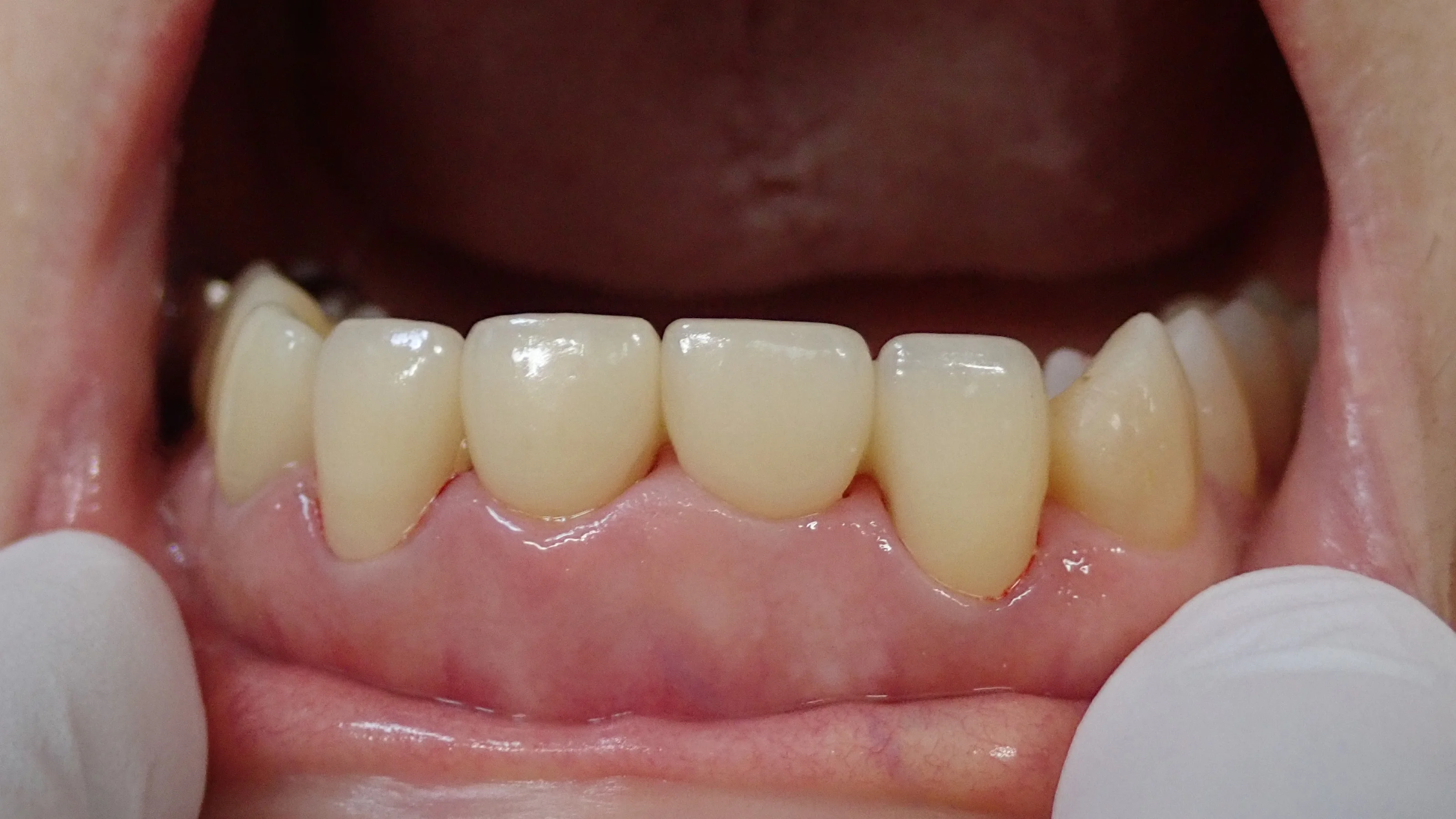 ブログ・お役立ち情報｜坂寄歯科医院（取手市藤代）