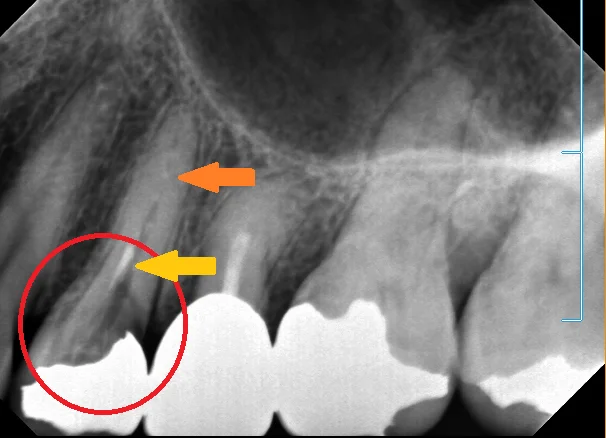 ブログ・お役立ち情報｜坂寄歯科医院（取手市藤代）