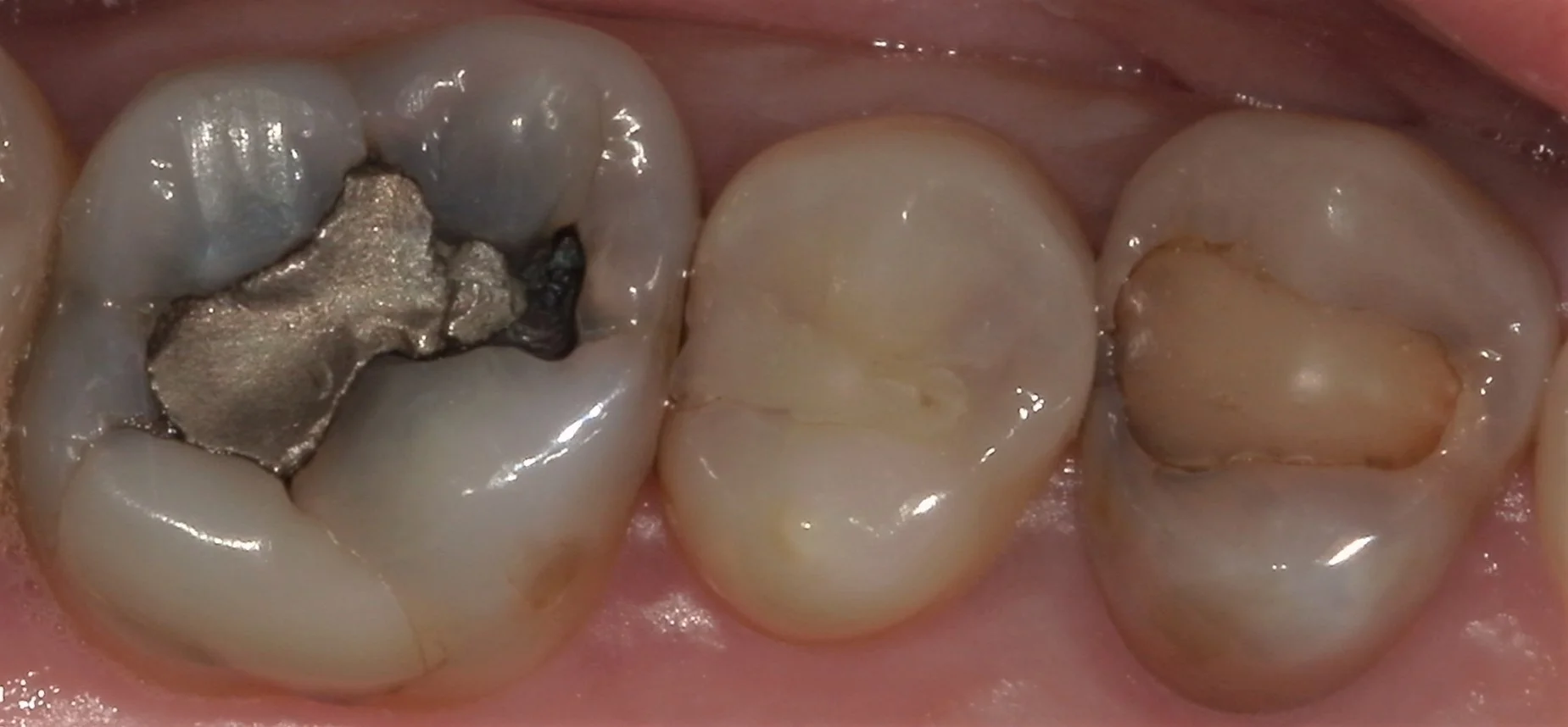 ブログ・お役立ち情報｜坂寄歯科医院（取手市藤代）