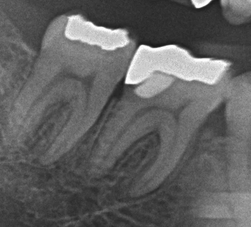 ブログ・お役立ち情報｜坂寄歯科医院（取手市藤代）