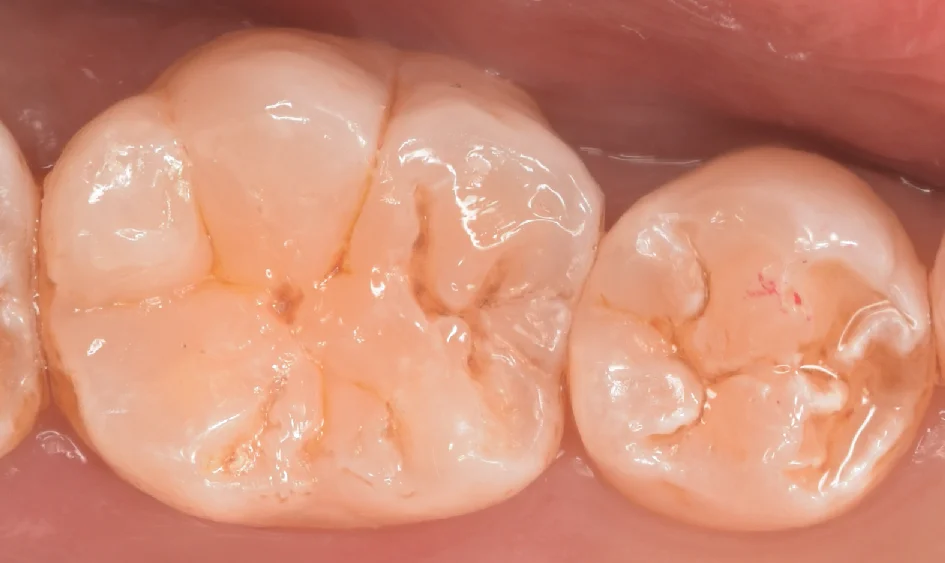 神奈川県からお越しの方|坂寄歯科医院(取手市藤代) - 画像5