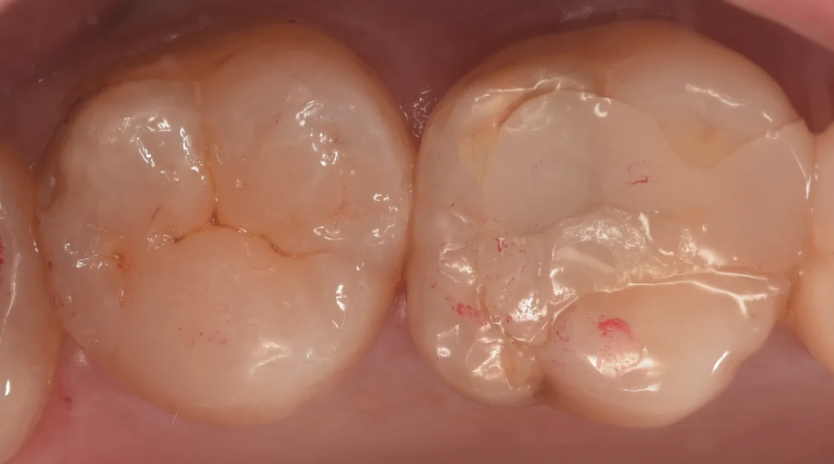 他県より来院された方。|坂寄歯科医院(取手市藤代) - 画像4