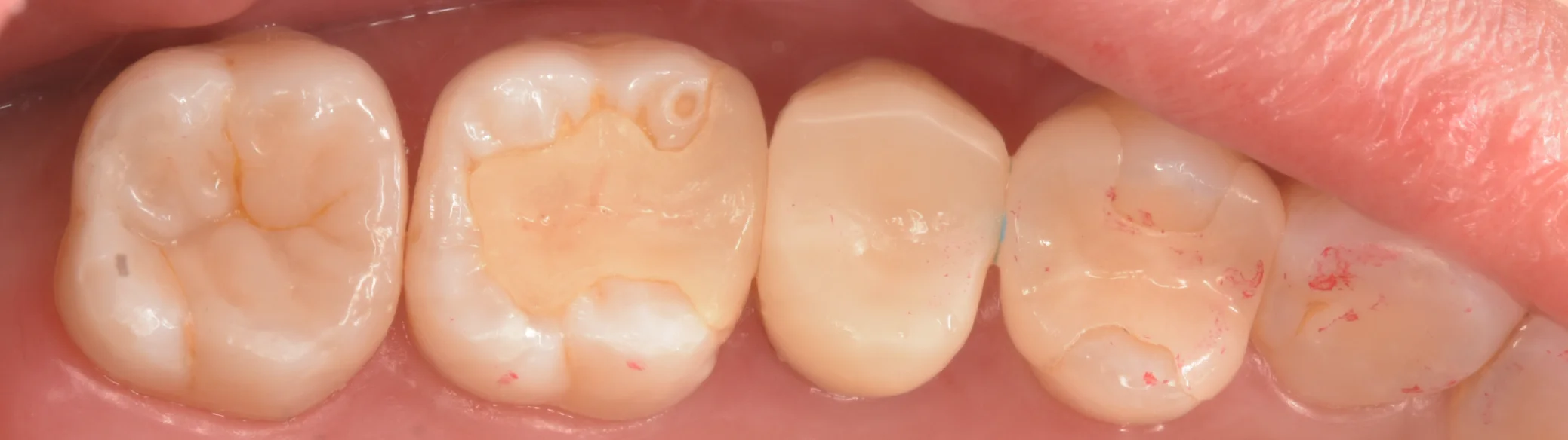 足立区からお越しの方。｜坂寄歯科医院（取手市藤代） - 画像7