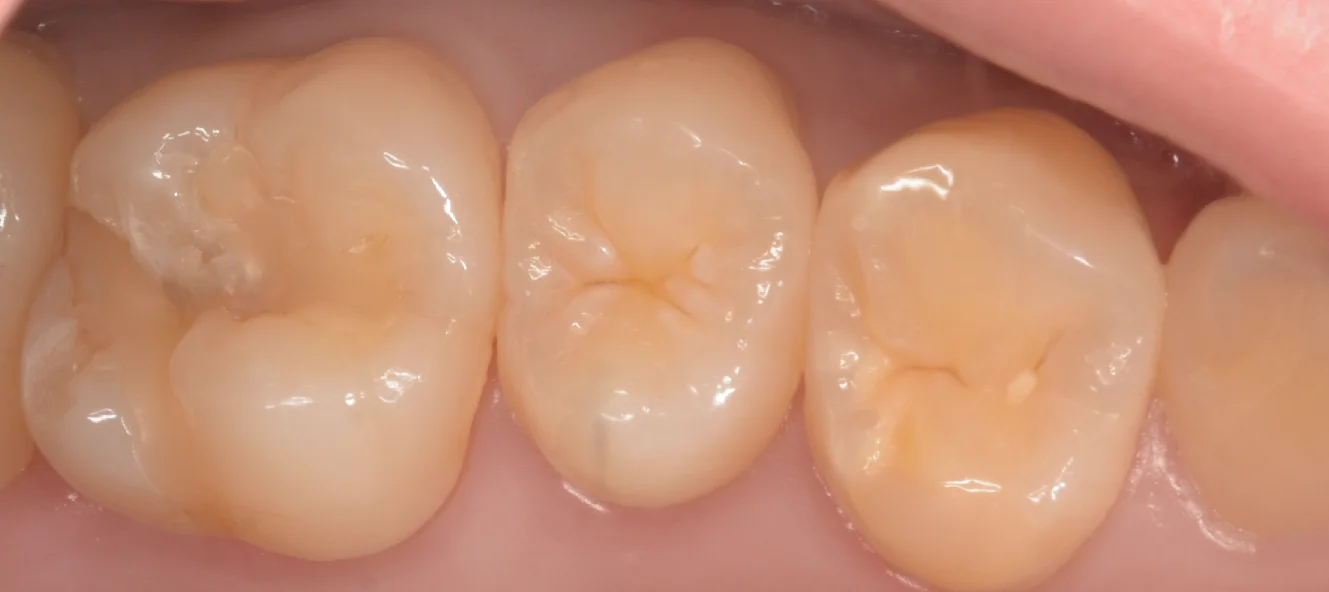 ブログ・お役立ち情報｜坂寄歯科医院（取手市藤代）