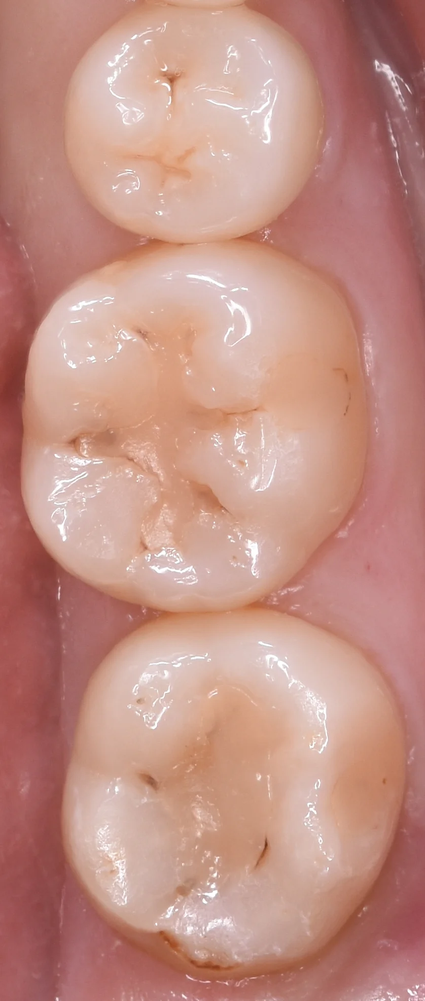 ブログ・お役立ち情報｜坂寄歯科医院（取手市藤代）