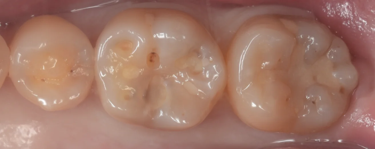 ブログ・お役立ち情報｜坂寄歯科医院（取手市藤代）