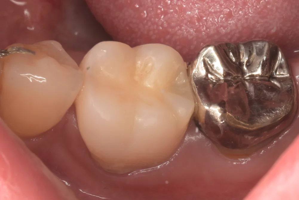 ブログ・お役立ち情報｜坂寄歯科医院（取手市藤代）