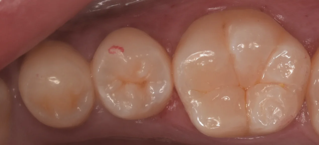 歯学部生をダイレクトで。｜坂寄歯科医院（取手市藤代） - 画像5