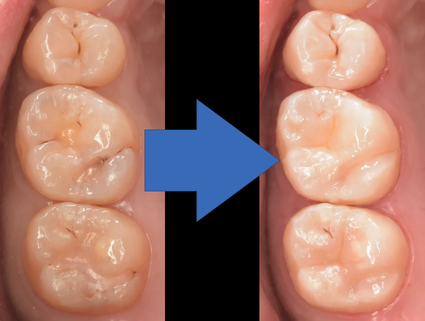 大田区からお越しの方|坂寄歯科医院(取手市藤代) - 画像5