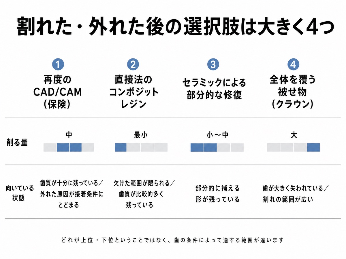 保険のCAD/CAM冠・インレーが割れた・外れた後の再治療の選択肢を4つに整理したインフォグラフィック。①再度のCAD/CAM（保険） ②直接法のコンポジットレジン ③セラミックによる部分的な修復 ④全体を覆う被せ物、それぞれの削る量と適する条件を並べた図